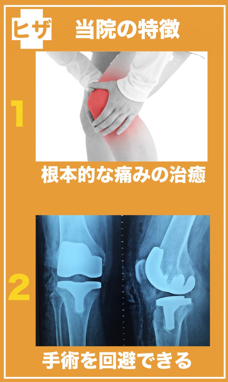 大久保整体院の膝施術の特徴